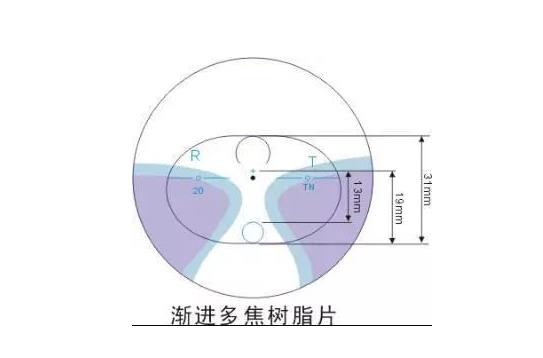 美麗島漸進(jìn)多焦鏡適合的人群，需要注意的事項