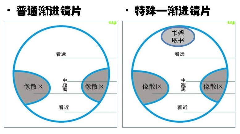 漸進(jìn)多焦鏡的原理與應用，3個(gè)光區，看遠近只需一副