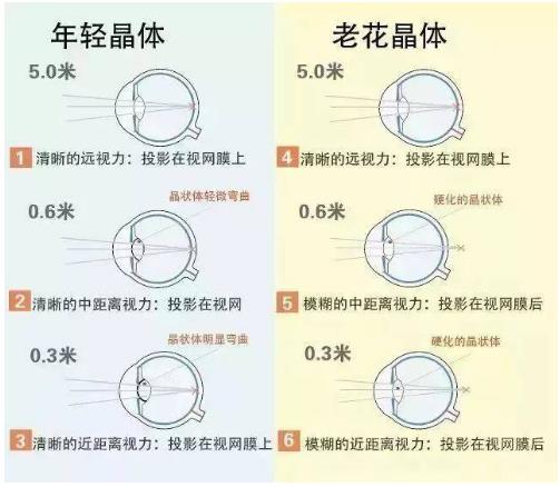 近視就不會(huì )老花了嗎？